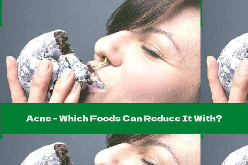 Acne - Which Foods Can Reduce It With?