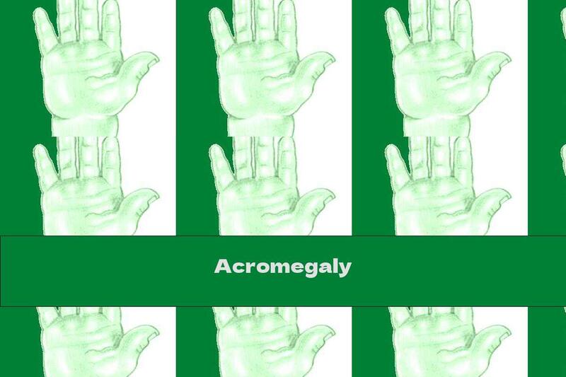 Acromegaly