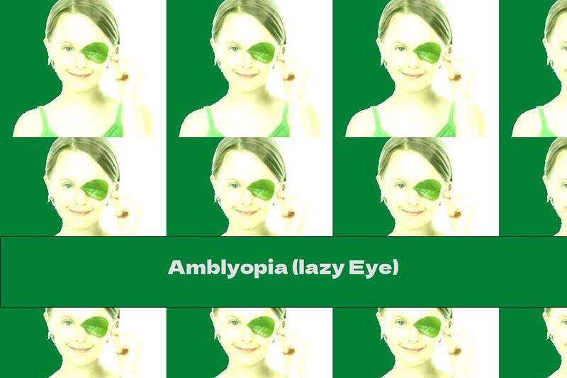 Amblyopia (lazy Eye)