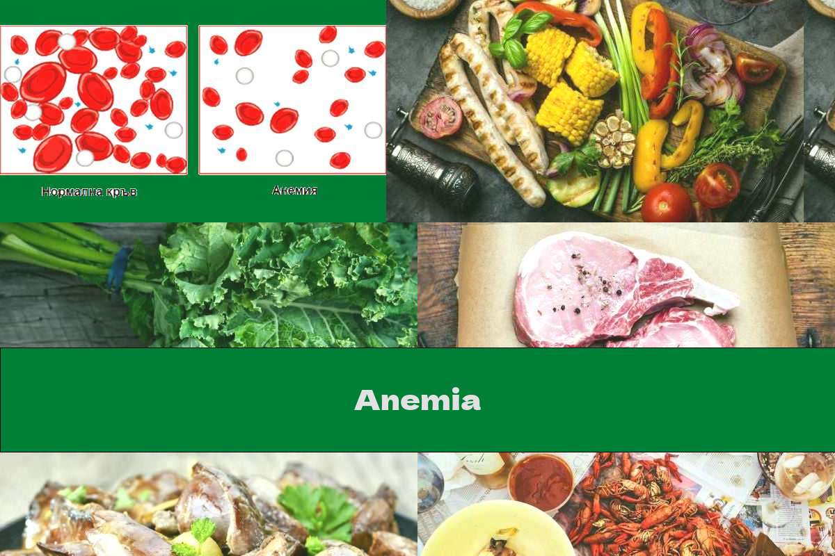 Anemia This Nutrition