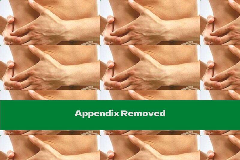 Appendix Removed