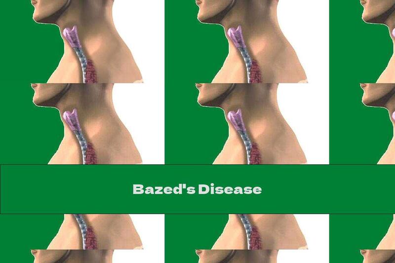 Bazed's Disease