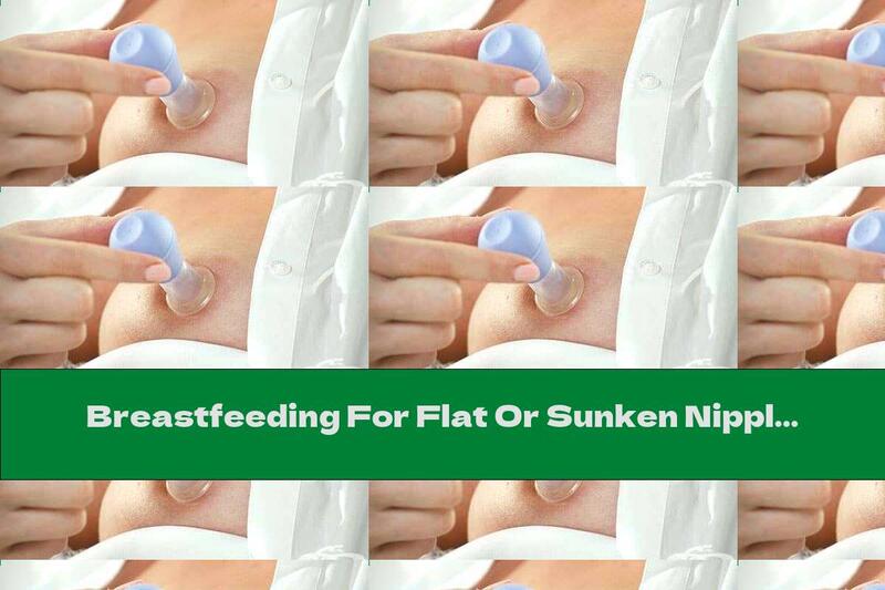 Breastfeeding For Flat Or Sunken Nipples
