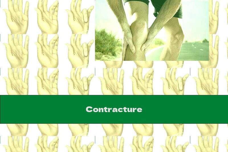 Contracture