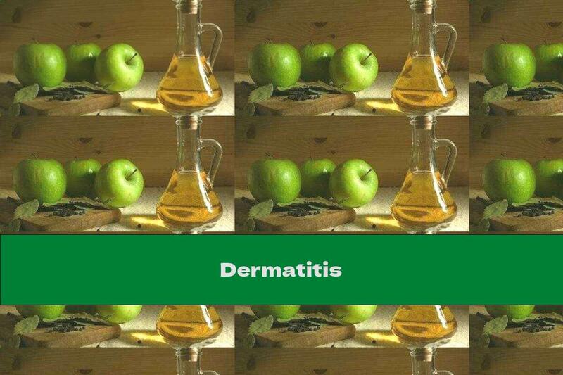 Dermatitis