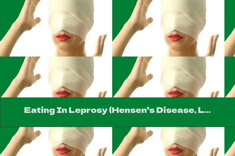 Eating In Leprosy (Hensen's Disease, Leprosy)