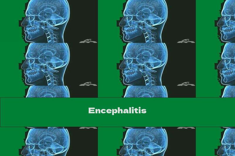 Encephalitis