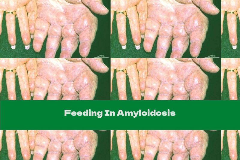Feeding In Amyloidosis