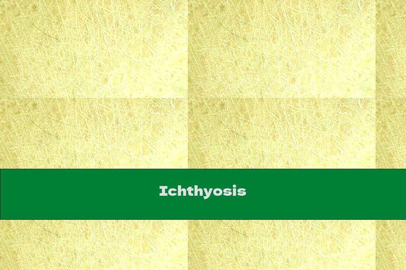 Ichthyosis