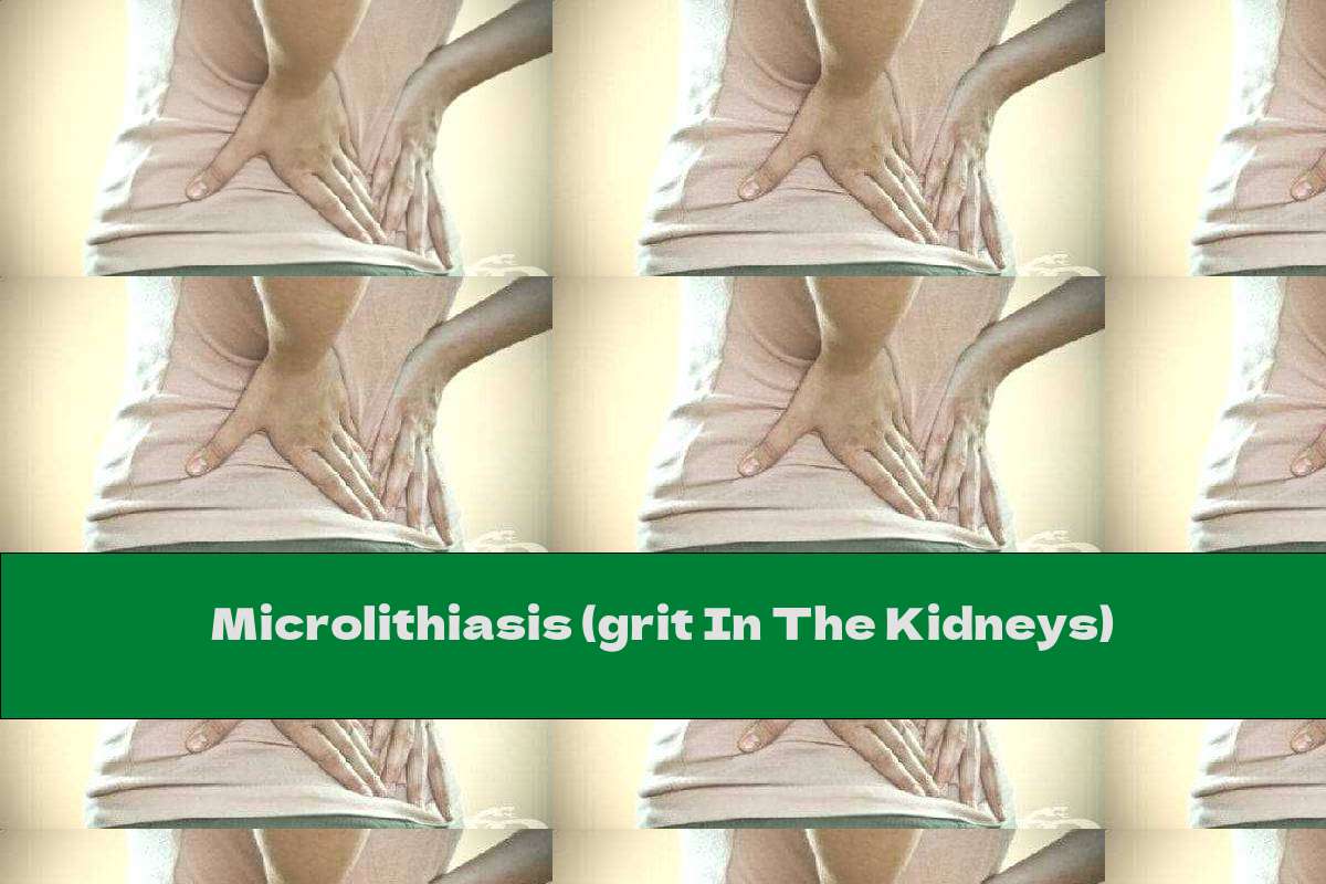 Microlithiasis (grit In The Kidneys) This Nutrition