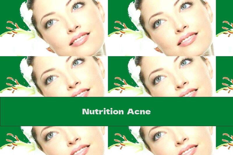Nutrition  Acne
