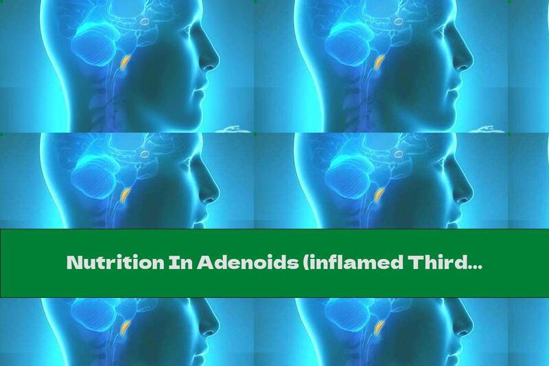Nutrition In Adenoids (inflamed Third Tonsil)