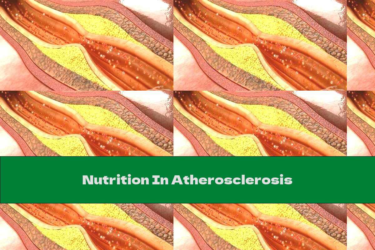 Nutrition In Atherosclerosis