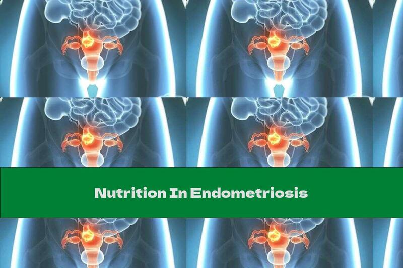 Nutrition In Endometriosis