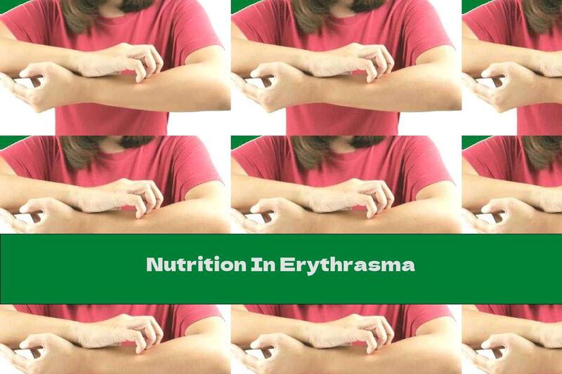 Nutrition In Erythrasma