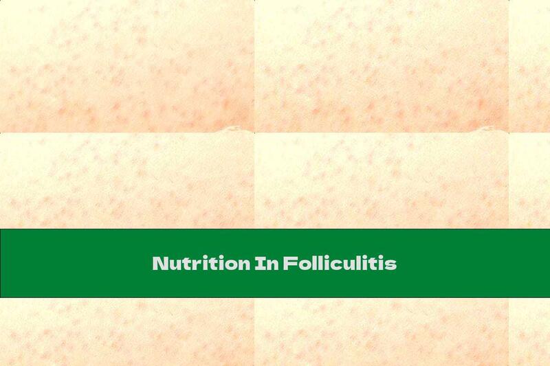 Nutrition In Folliculitis