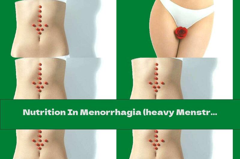 Nutrition In Menorrhagia (heavy Menstruation)