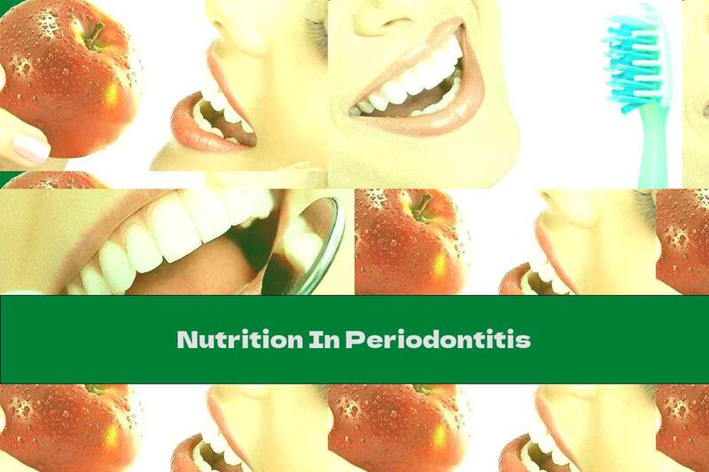 Nutrition In Periodontitis