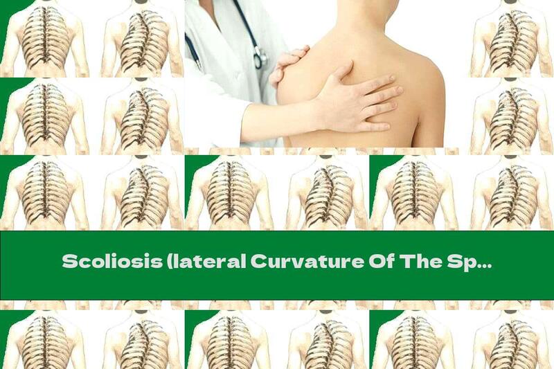 Scoliosis (lateral Curvature Of The Spine)