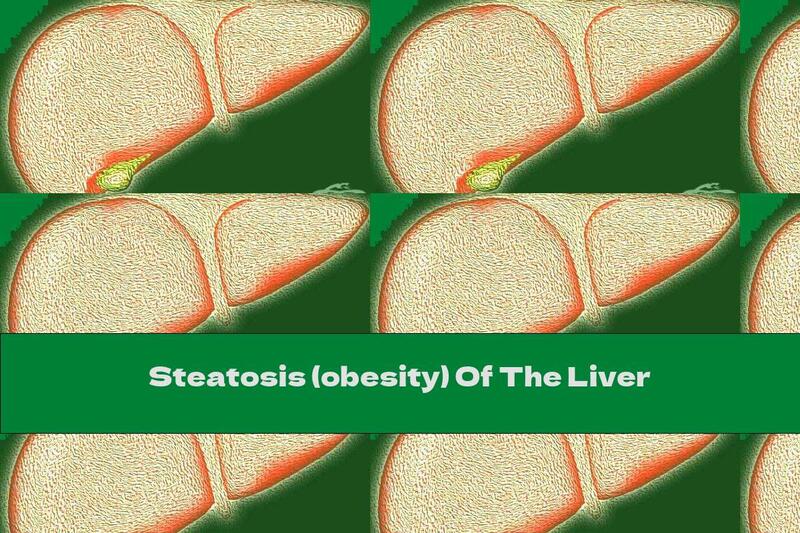Steatosis (obesity) Of The Liver