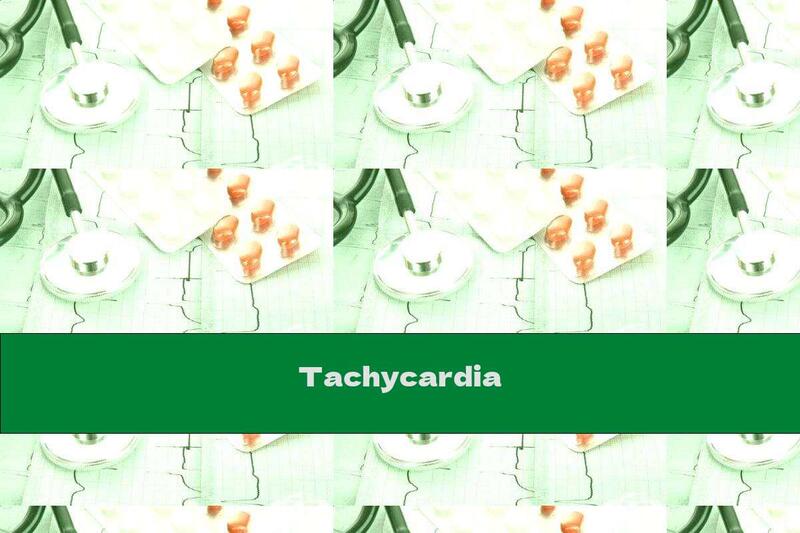Tachycardia
